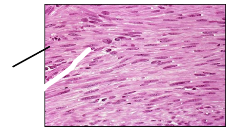 <p>What type of smooth muscle tissue is this?</p>