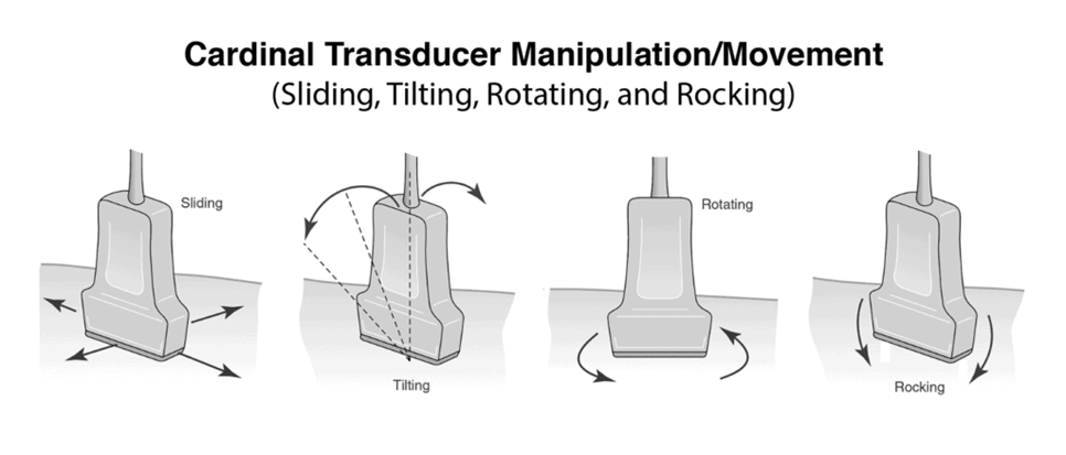 <p>What is 'Rotate' movement of the transducer?</p>