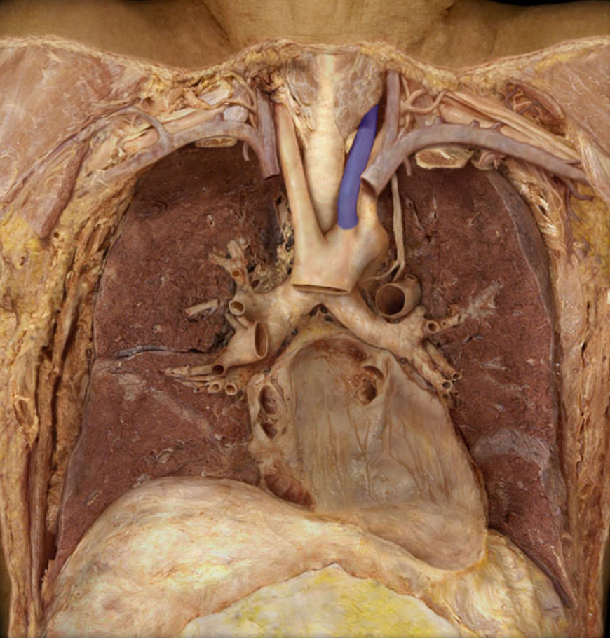 <p>Identify the structure</p>