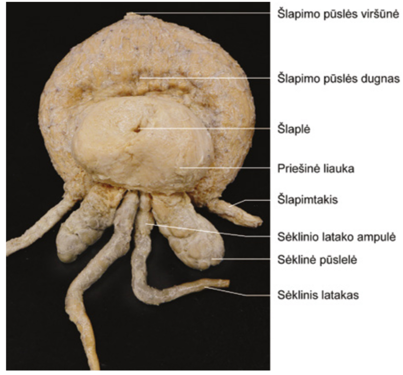 <p>Ka jungia slaple?</p>