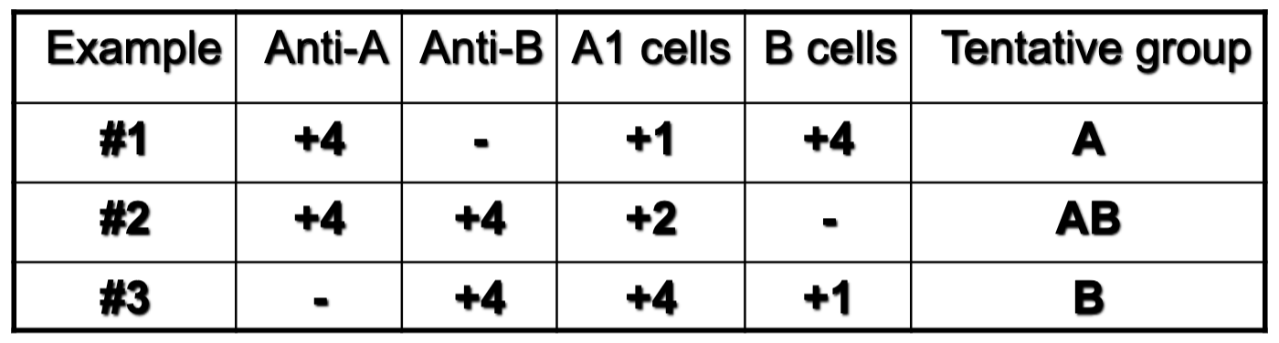 <p>which example depicts irregular IgM allo antibodies?</p>