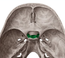 term image