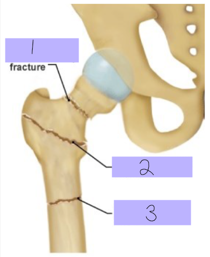 <p>#2</p>