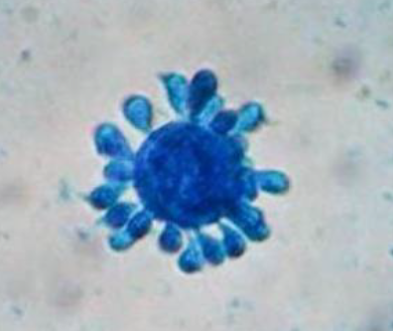 <p>Exudate from a lesion of the mouth of a patient in South America was sent to the lab and inoculated for a fungal culture. The mold phase of an organism grew on PDA showing a folded, white, glabrous colony and the yeast phase showed cream, waxy colonies. The lactophenol blue stain of this organism is pictured below. What is organism identification?</p>