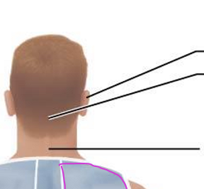 <p>Posterior Axial Region: Cephalic and Cervical </p>