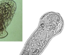 <p>What life cycle stage is this?</p>