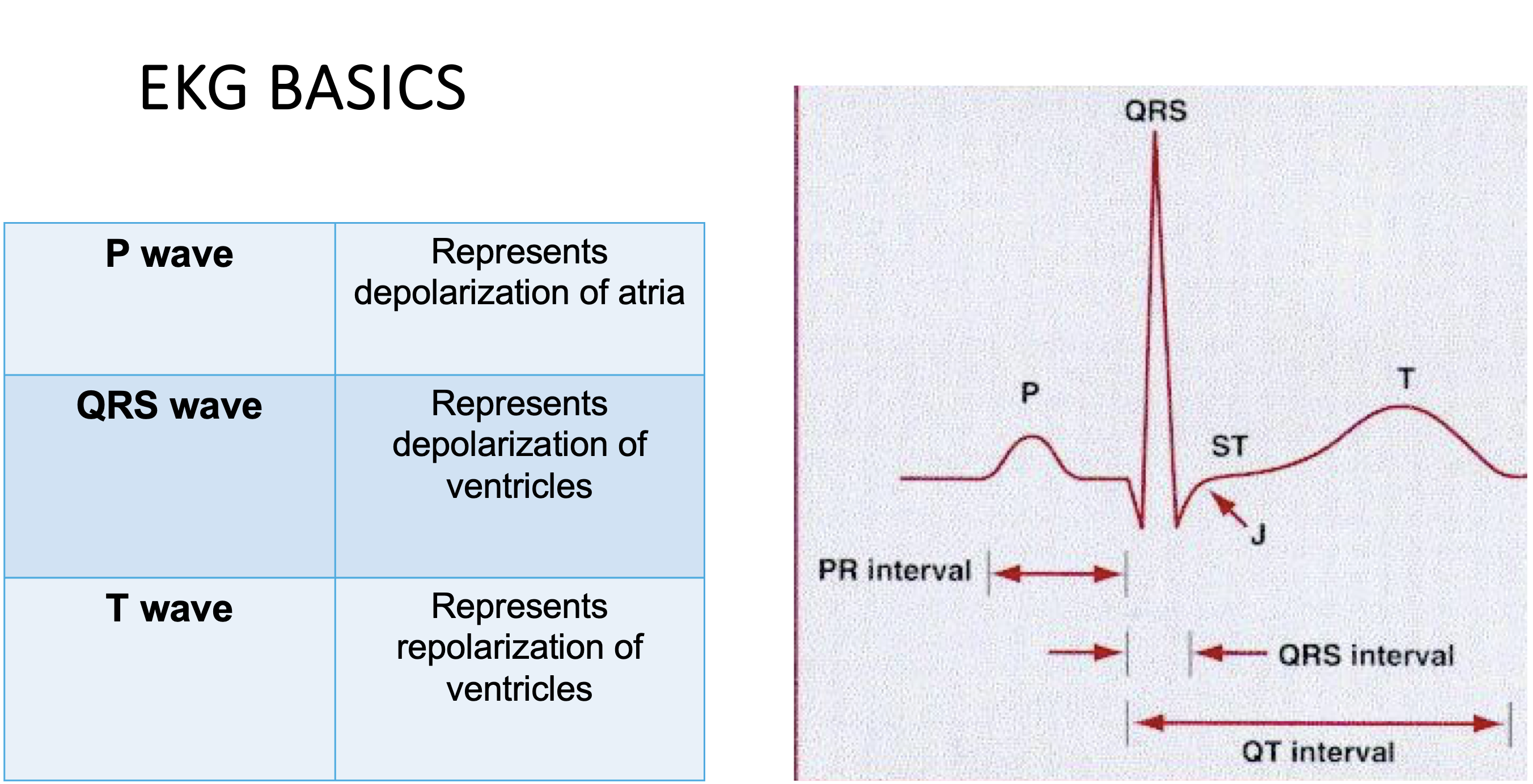 <p>EKG basics </p>