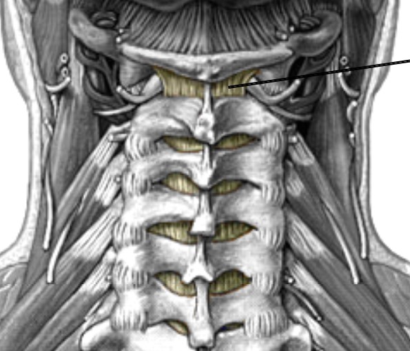 <p>Which ligament of the intervertebral connects laminae (yellow ligament)?</p>