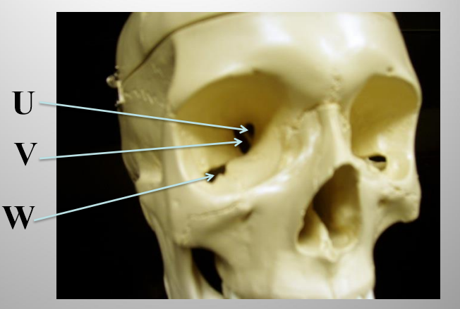 <p>What structure is letter W?</p>