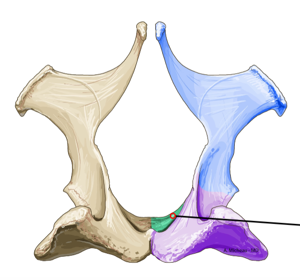 <p>Cranial ventral part of pelvis; forms pubic symphysis medially.</p>