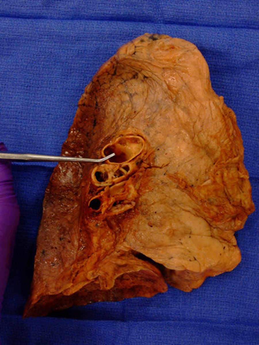 <p>Label the Artery</p>