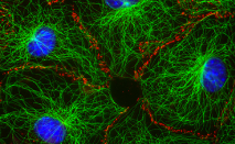 <ol><li><p><span>In nondividing cells, microtubule networks provide the basic organization of the cytoplasm, including the positioning of organelles</span></p><ol><li><p><span>Core of cilia and flagella</span></p></li><li><p><span>In dividing cells, they make the spindle that ensures the proper distribution of the chromosomes</span></p></li><li><p><span>Assembly of microtubules is such an unfavorable reaction that in at least animal cells onlyhappens in the presence of microtubule-organizing centers (MTOCs)</span></p></li><li><p><span>The centrosome is the main MTOC in animal cells. During interphase, it is located near the nucleus and MTs irradiate from it</span></p></li></ol></li></ol><p></p>