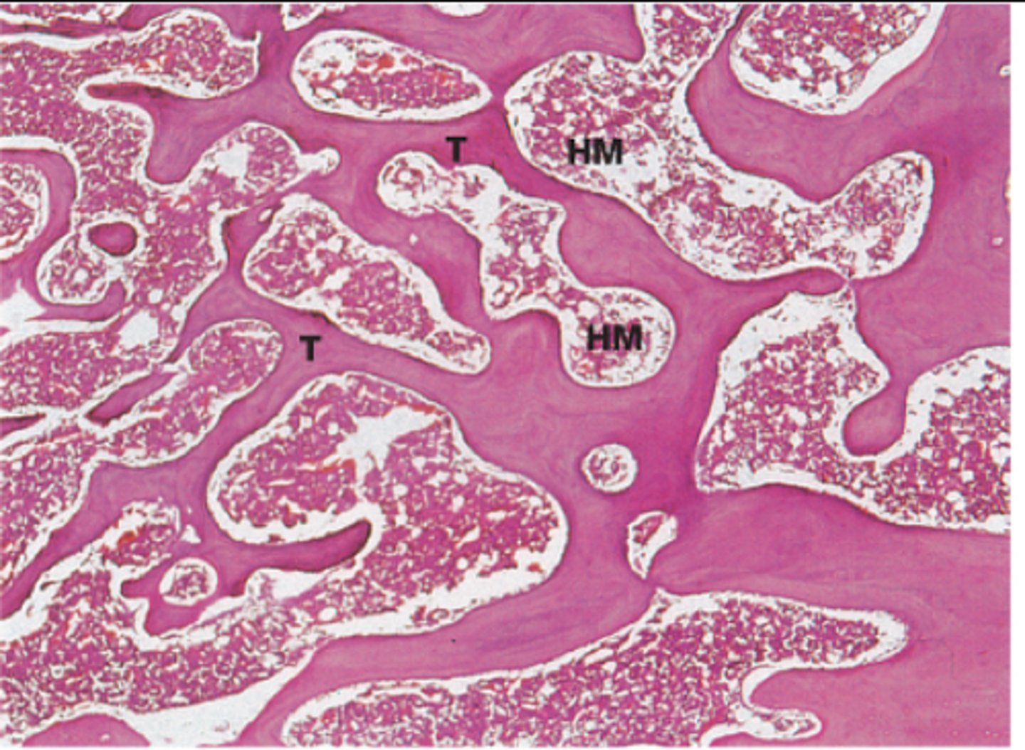<p>thousands of interconnecting bony plates called trabeculae</p><p>many open spaces that house portion of bone marrow</p><p>found in ends of long bonds as well as near the interior of both long and flat bones</p>
