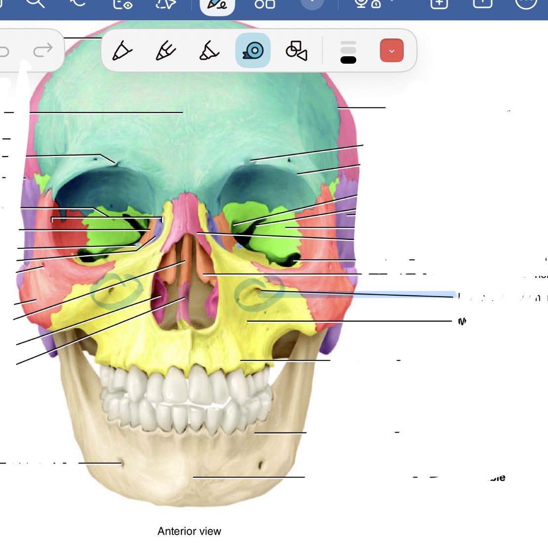 <p>What bone is this and its marking </p>