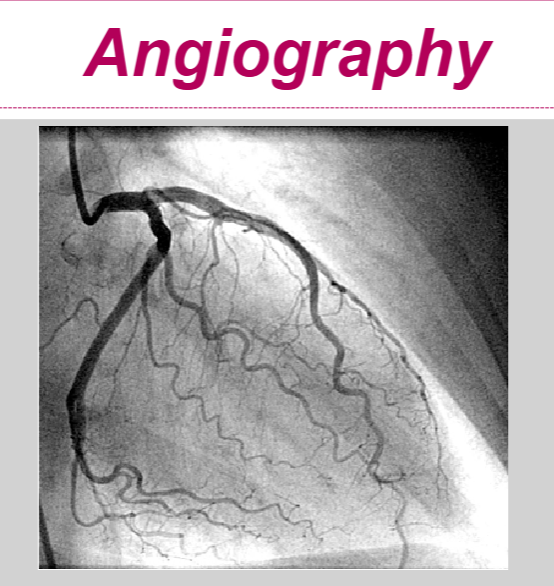 <ul><li><p>invasive procedure—&gt; to assess patency of coronary vessels and hemodynamic parameters of cardiac fxn</p></li><li><p>requires IV contrast and fluoroscopy</p></li><li><p>angiography—&gt; assesses for coronary artery blockages</p></li></ul><p></p>