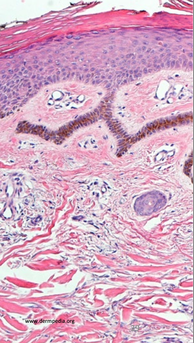 term image