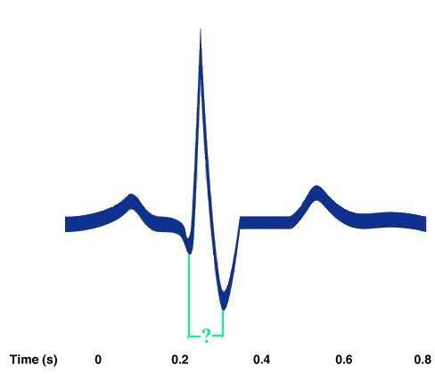 <p><span><span>Identify the indicated portion of the EKG.</span></span></p>