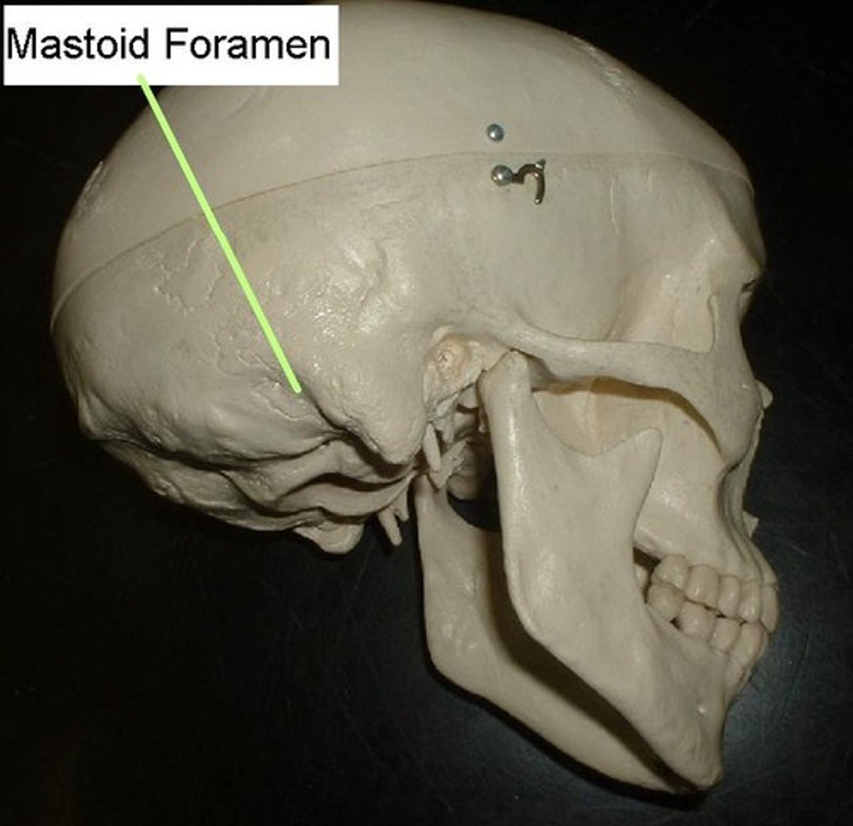 <p>Mastoid emissary vein from sigmoid sinus and meningeal branch of occipital artery</p>