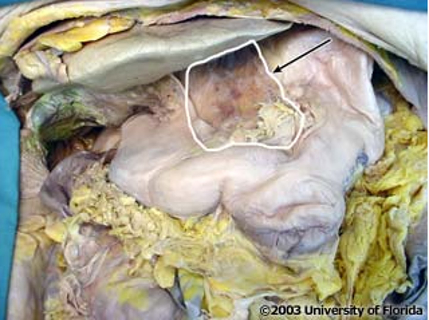 <p>connects liver to stomach</p>
