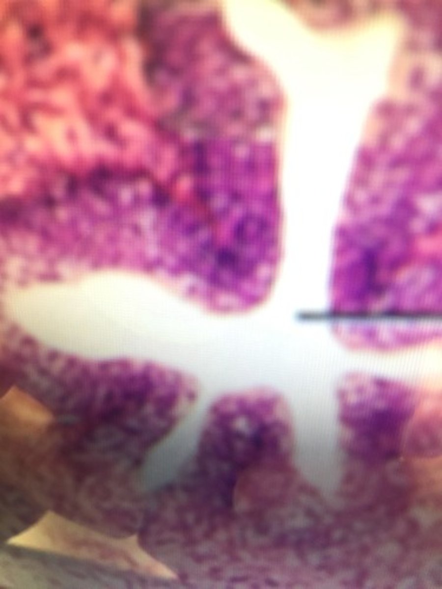 <p>Cavity that is connected to the epididymis and Spermatic duct.</p>