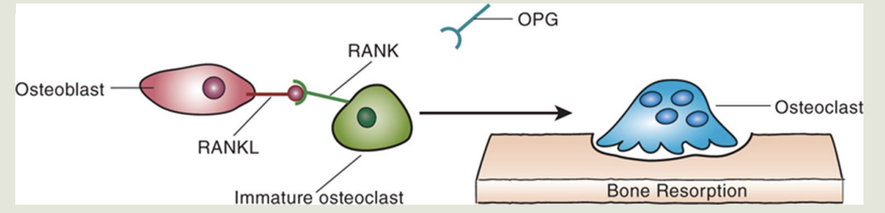 <p><strong>Osteoprotegerin (OPG)&nbsp;</strong></p><ol><li><p><strong>Protein</strong> signaling <strong>molecule produced by osteoblasts</strong></p></li><li><p><strong>Protects</strong> bone from <strong>excessive resorption by</strong></p></li></ol><ul><li><p><strong>Binding to RANKL</strong></p></li><li><p><strong>Blocking binding with RANK</strong></p></li></ul><p></p>