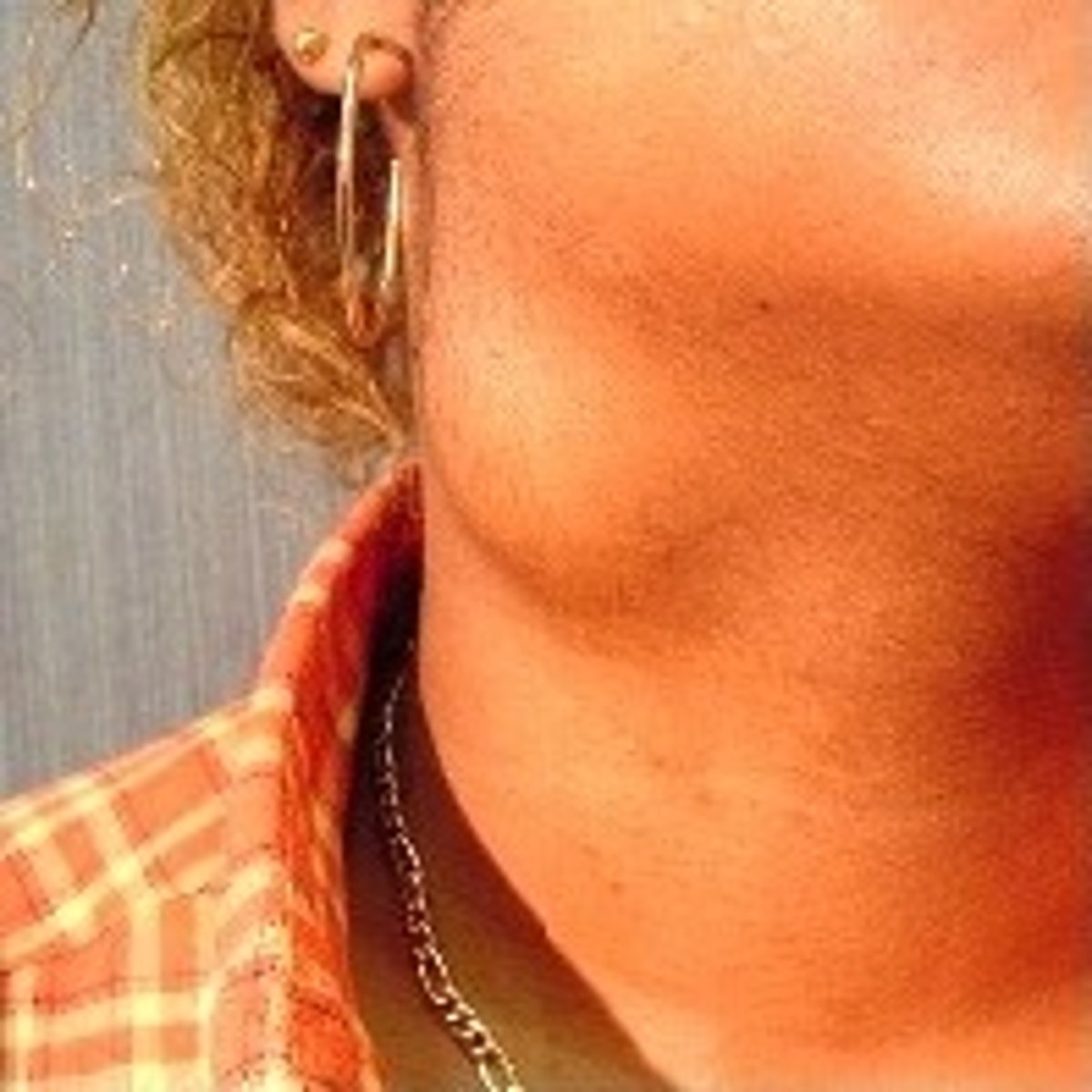 <p>lateral neck - anterior to SCM muscle</p>