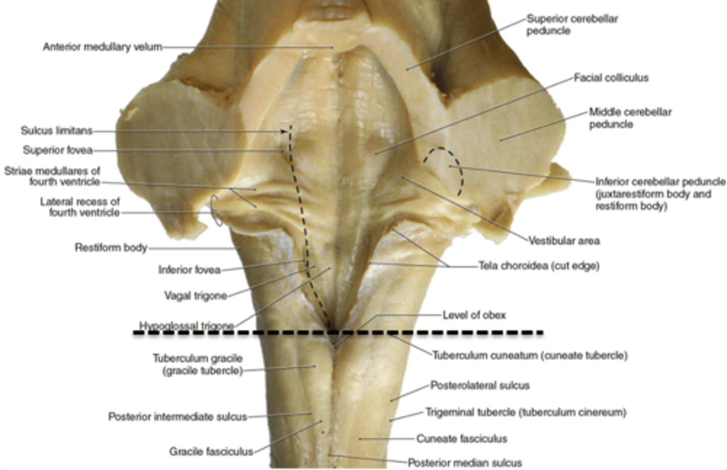 <p>1. open (rostral) medulla</p><p>2. closed (caudal) medulla</p>