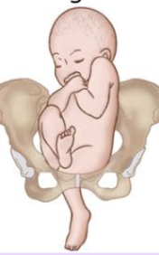 <p>1 or both of the hips are not completely flexed</p>