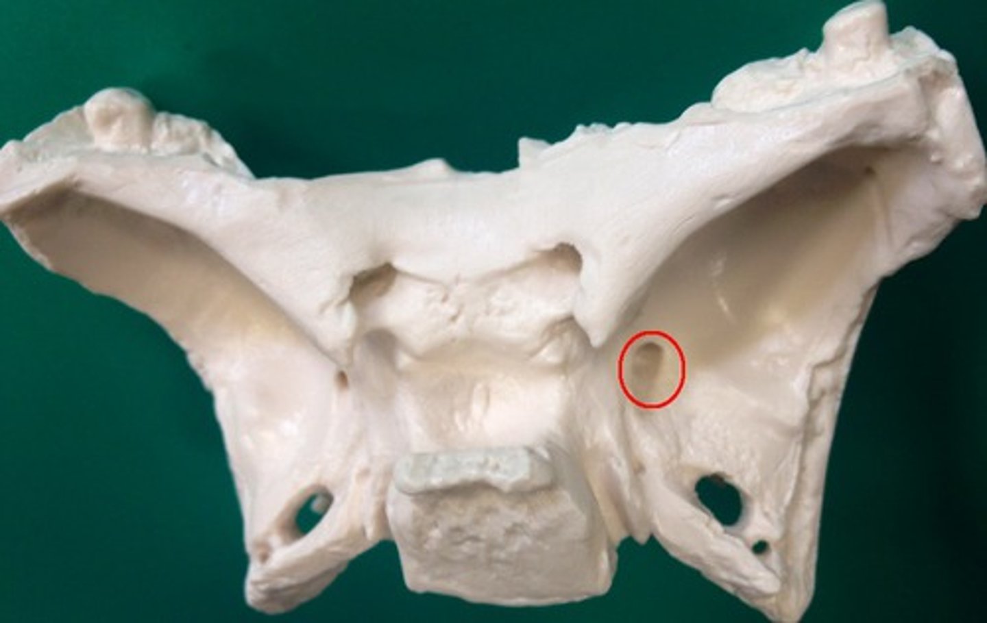 <p>Label the sphenoid bone</p>