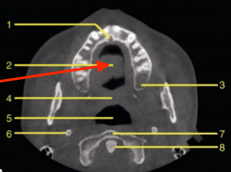 <p>identify the structure </p>