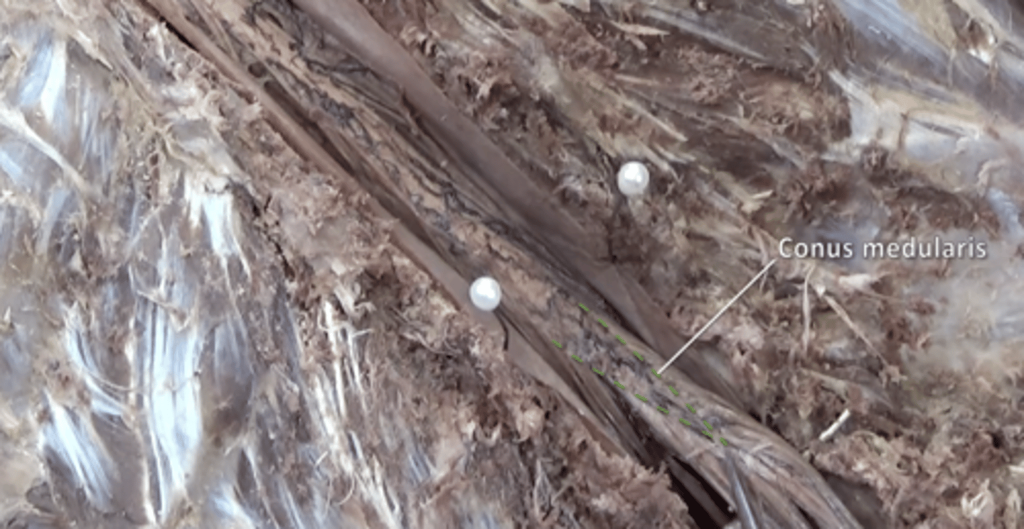 <p>tapered end of spinal cord located inferior to lumbar enlargement between L1 and L2</p>