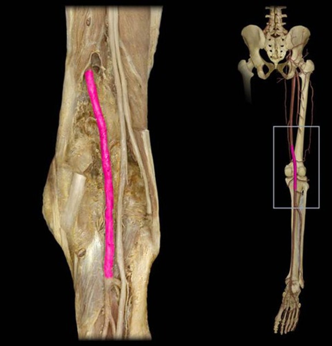 <p>Name this vessel.</p>