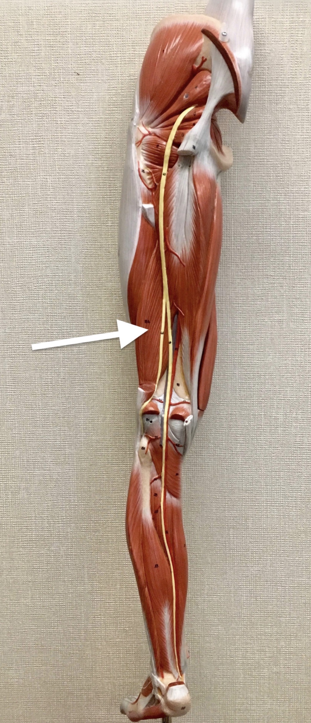 <p><span>Name the muscle AND the head labeled with the white arrow below:</span></p>