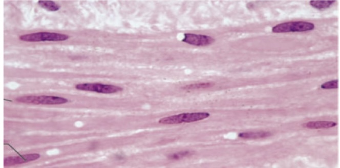 <p>spindle shaped with central nuclei </p><p>propels substances </p><p>in the walls of hollow organs (digestive)</p>