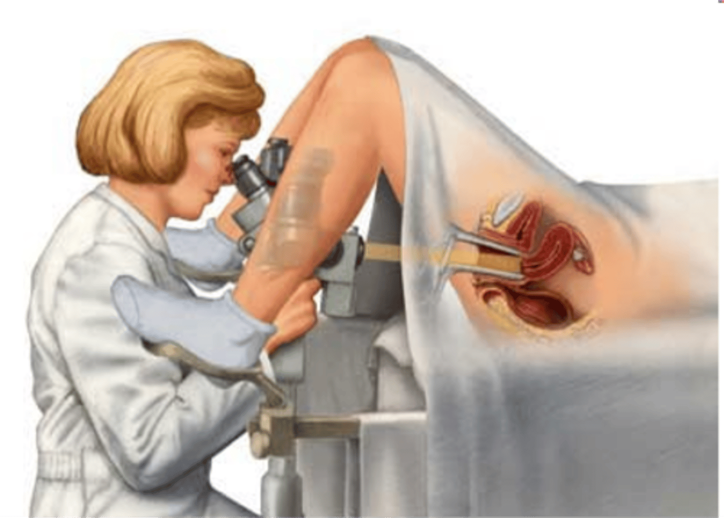 <p>Visual exam of the vagina and cervix</p>