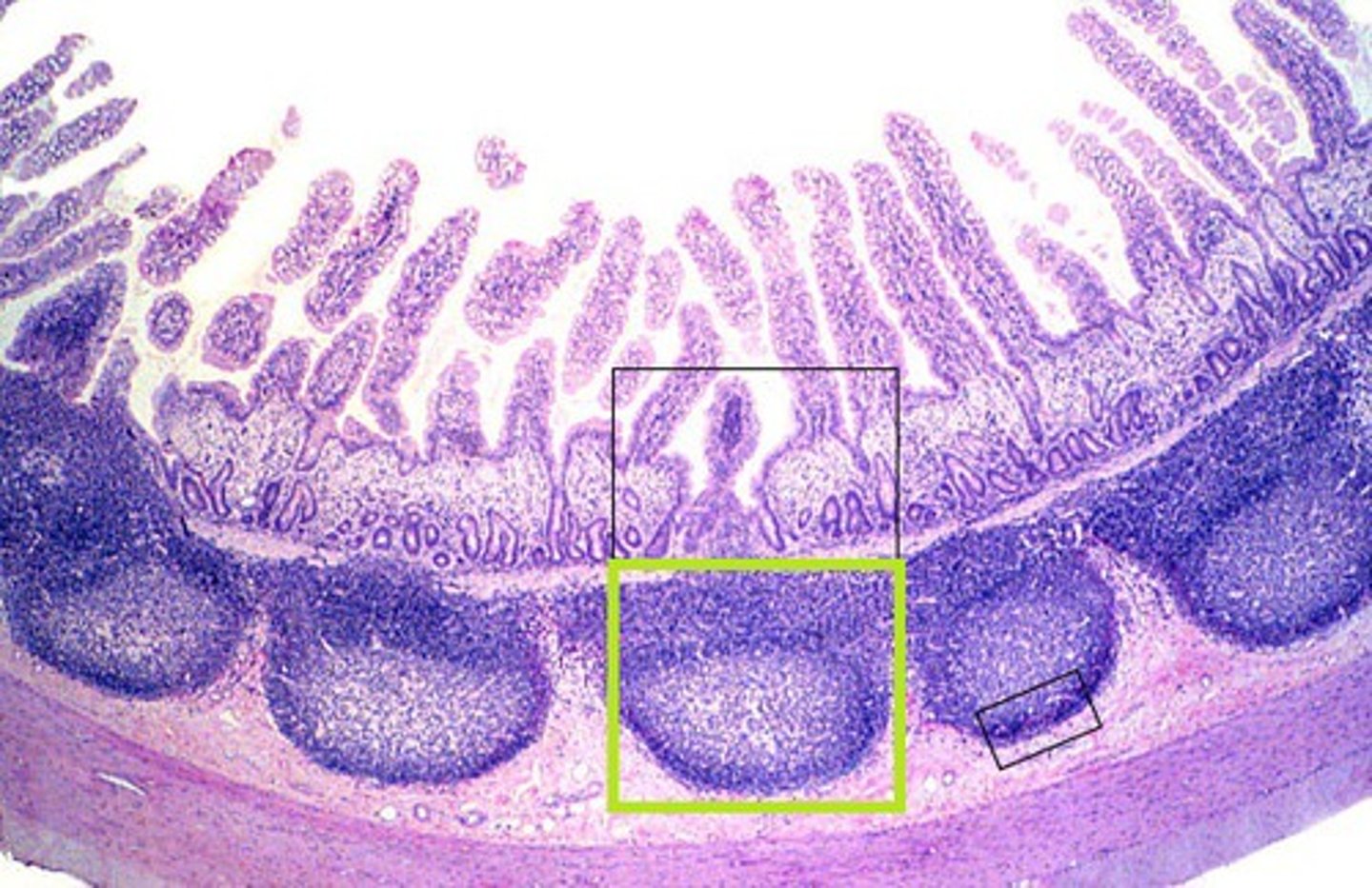 <p>large collections of lymphoid tissue found in the submucosa of the small intestine</p>