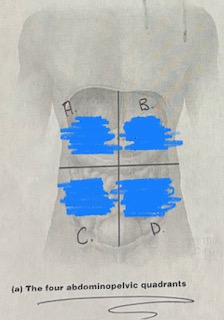 <p>C and D Quadrants</p>