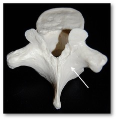 Name this bony landmark of the vertebra.