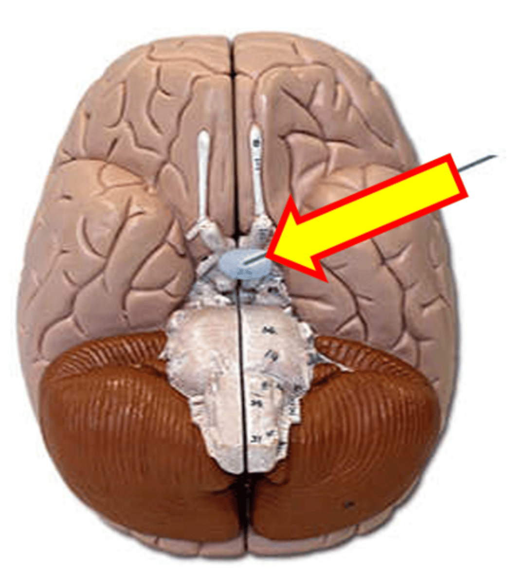 <p>Name the structure.</p>