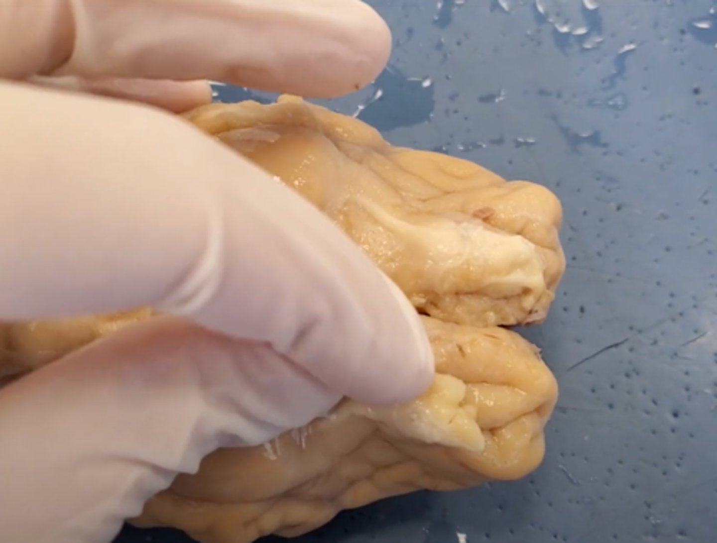 <p>a brain structure located above the nasal cavity beneath the frontal lobes</p>