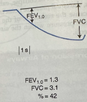 <p>What type of respiratory pattern is this?</p>