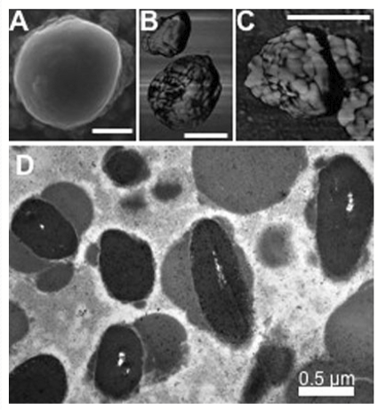<p>Vesicles are found within the RPE that are composed of incomplete degradation of internalized macromolecules from visual cycles. </p>