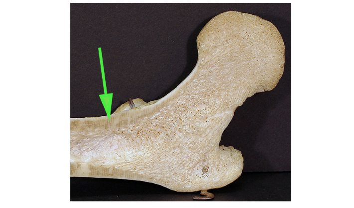 <p>What type of bone tissue is marked by the green arrow?</p>