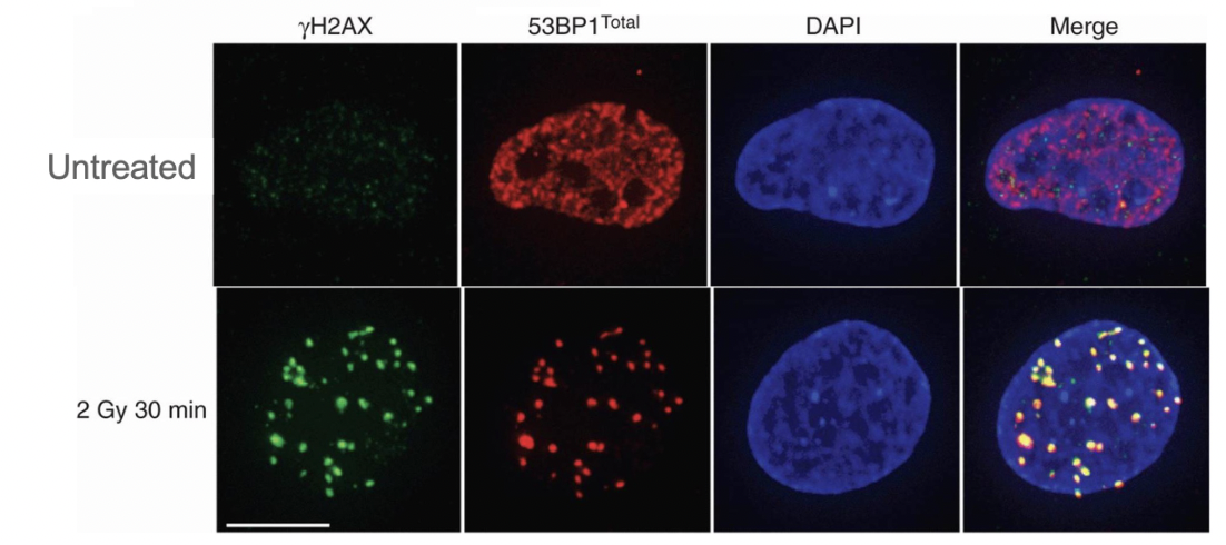 <p>Flourescence microscopy to see Co-localization</p><p>aka Indirect immunofluorescence using 2 antibodies </p><p>where H2AX and 53BP1 overlap there is prob DNA damage</p><p>or combine Telomere FISH with 53BP1 staining to see overlap</p>