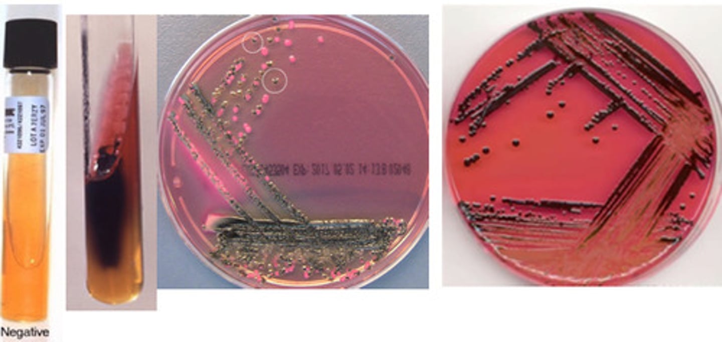 <p>GNB, enterbacterale, oxidase neg, lactose neg, confirm with serology (Paratyphi A is H2S neg)</p>