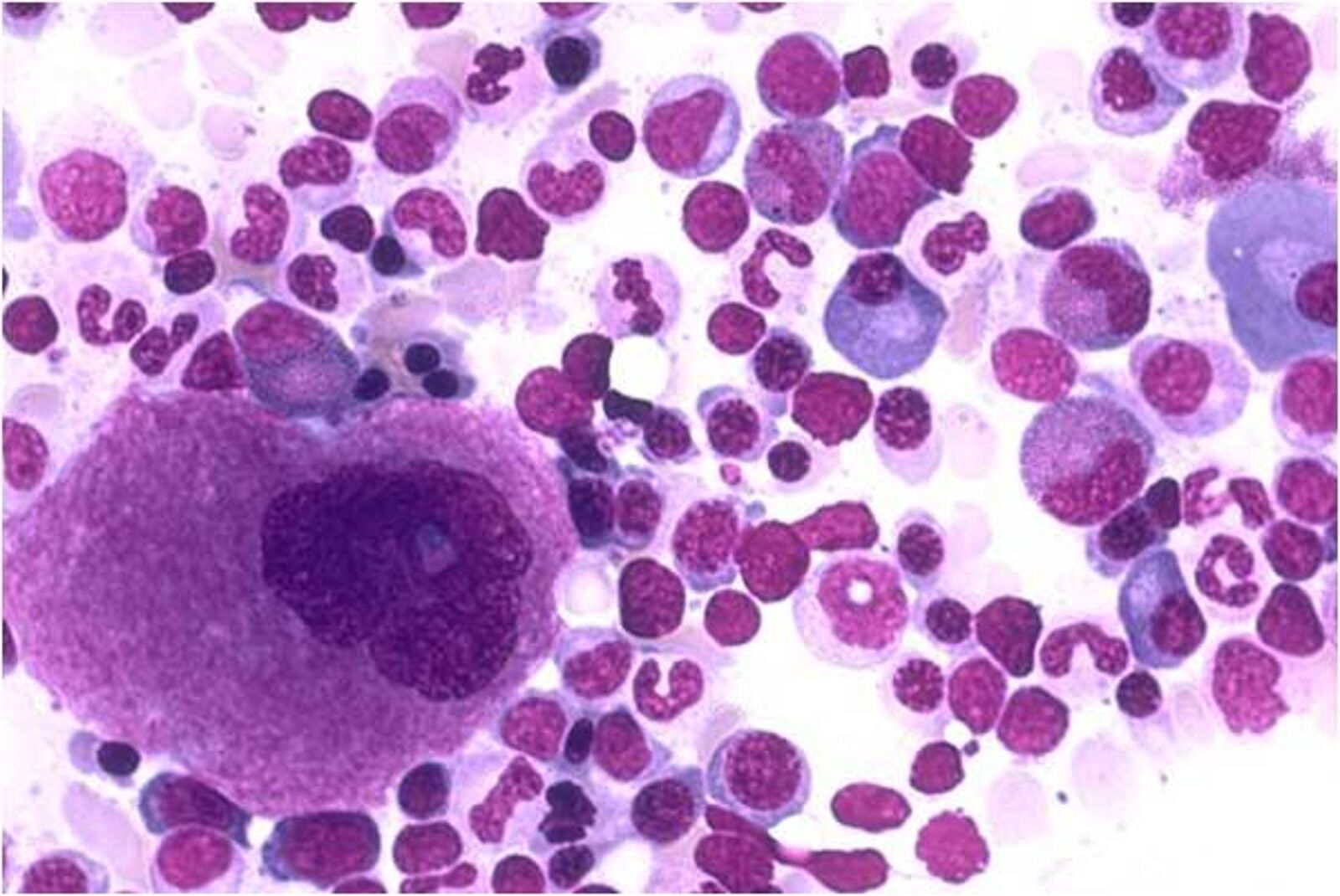 <p>What is the large cell and what does it mature into?</p>