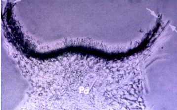 <p>conidioma asexual</p>