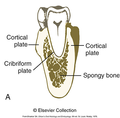 <p><span>is the hard outer layer of bone. It is bone that is made up of osteoblasts, osteocytes, collagen fibers and ground substance. It also has microscopic crystals of a substance called hydroxyapatite.</span></p><ul><li><p>These crystals of calcium and phosphates are found packed into the ground substance and fibers between cells, giving bone its hardness.</p></li><li><p>Compact bone that is on the buccal and lingual surface is called<strong> cortical bone</strong>. The <strong>cribriform plate</strong> is also compact bone. It forms the tooth socket and contains holes for the passage of blood vessels.</p></li></ul><p></p>