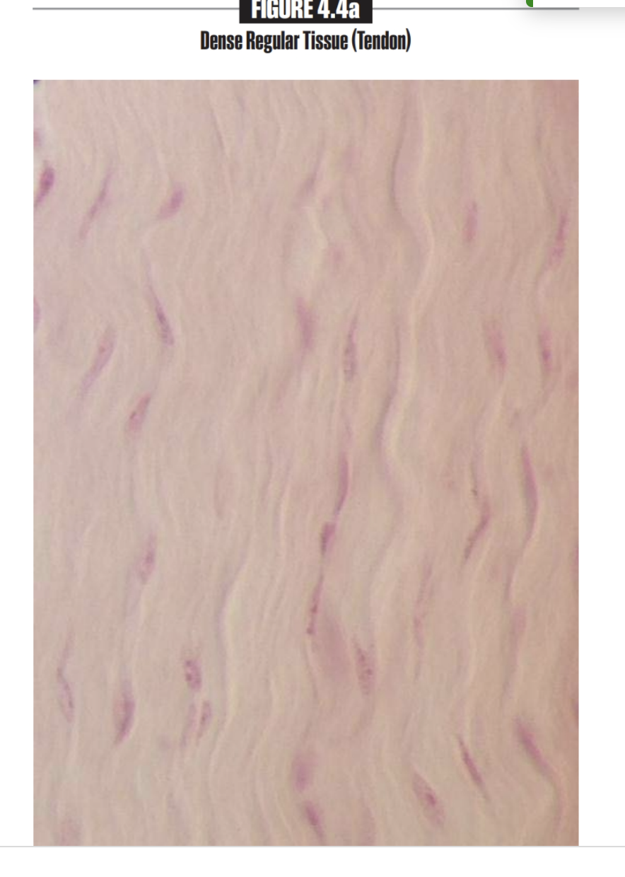 <p>Dense regular tissue</p><p></p>