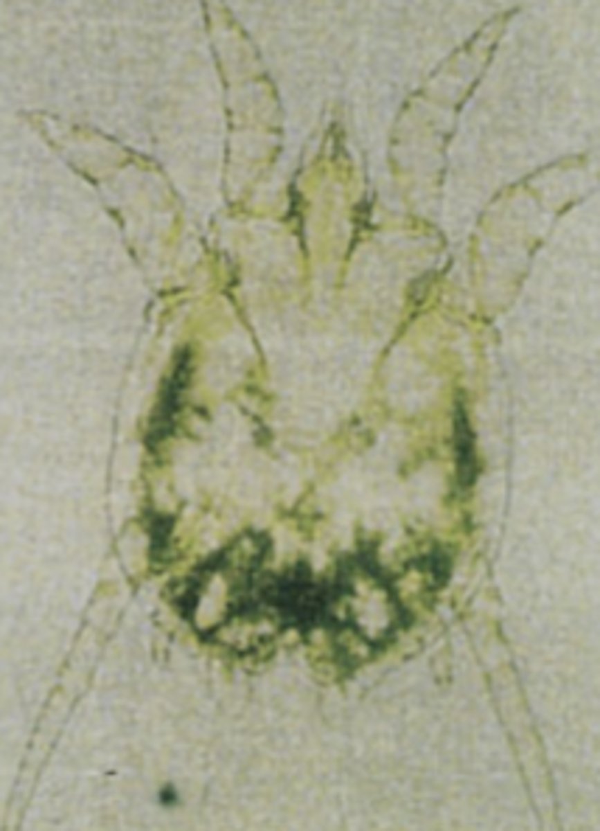 <p>?</p>
